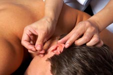 Man getting auricular acupuncture.